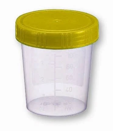 Urine cups with screw cap, yellow, sterile, single packed, sterile